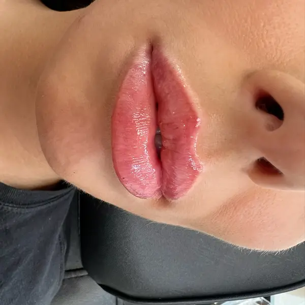 Before and after Lip blush deep berry by Lorraine, Gold Coast