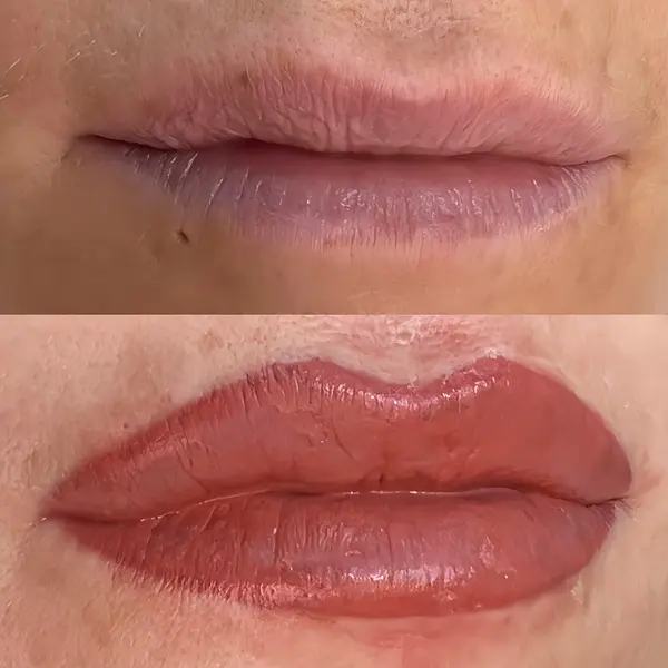 Before and after Lip blush mature skin restoration by Lorraine, Gold Coast